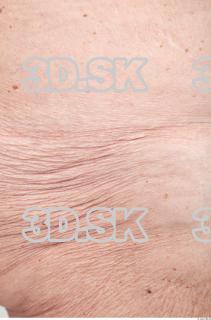 Skin texture of Shelia 0002